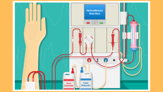 Hemodialysis-Your-Dialysis-Machine