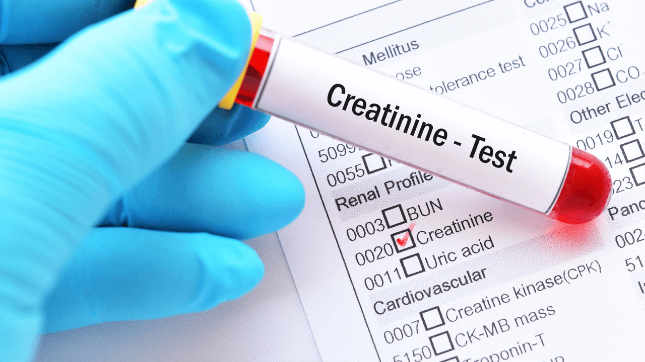 Creatinine Measurement Chart